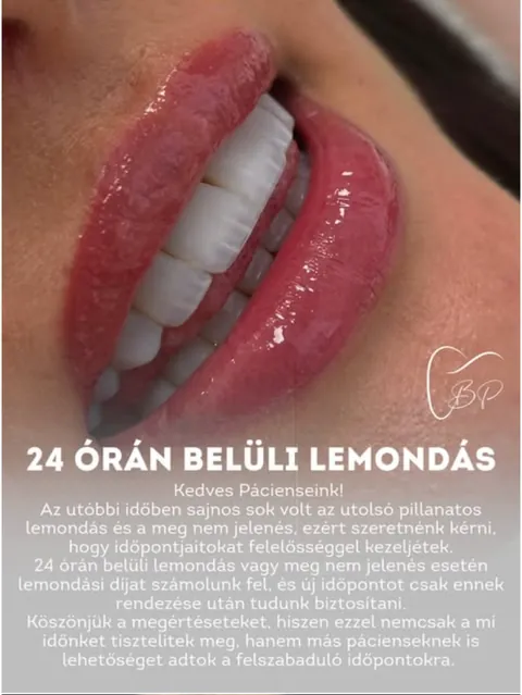 Bp Esztétikai Fogászat Instagram: Szöveges poszt: 24 órán belüli lemondás, ajkak közelről
